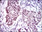 FOXP1 Antibody